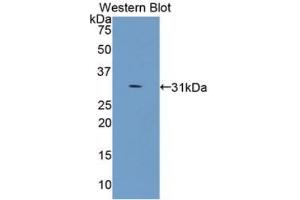Western blot analysis of recombinant Human COL4a5. (COL4a5 抗体)