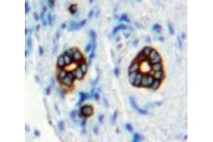 Immunohistochemistry (IHC) image for anti-Mannose Receptor, C Type 1 (MRC1) (AA 225-492) antibody (ABIN7433762)