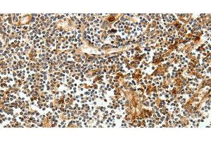 Immunohistochemistry of paraffin-embedded Human tonsil tissue using CEACAM21 Polyclonal Antibody at dilution 1:60 (CEACAM21 抗体)