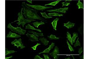Immunofluorescence (IF) image for anti-Phosphatidylinositol-5-Phosphate 4-Kinase, Type II, alpha (PIP4K2A) (AA 1-406) antibody (ABIN518910)