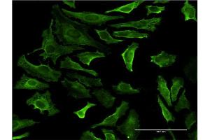Immunofluorescence of monoclonal antibody to PIP4K2A on HeLa cell.