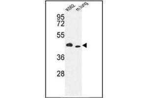 Image no. 1 for anti-Inositol-Trisphosphate 3-Kinase A (ITPKA) (AA 353-382), (C-Term) antibody (ABIN360691) (ITPKA 抗体  (C-Term))