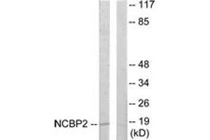 Western blot analysis of extracts from COLO205 cells, using NCBP2 Antibody. (NCBP2 抗体  (AA 10-59))