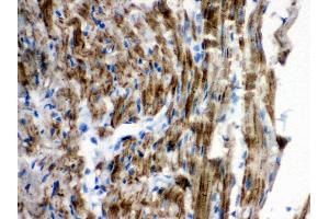 Anti-VDAC Picoband antibody, IHC(P) IHC(P): Rat Cardiac Muscle Tissue (VDAC1 抗体  (Middle Region))