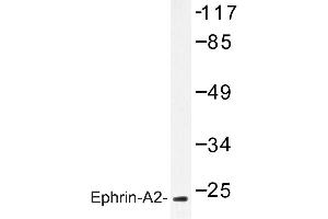 Image no. 1 for anti-Ephrin A2 (EFNA2) antibody (ABIN272138) (Ephrin A2 抗体)