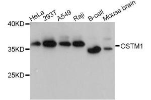 Western blot analysis of extracts of various cell lines, using OSTM1 Antibody (ABIN5998424) at 1:3000 dilution. (OSTM1 抗体)