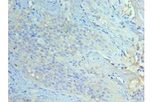 Immunohistochemistry of paraffin-embedded human tonsil tissue using ABIN7151465 at dilution of 1:100 (GCN2 抗体  (AA 1-300))