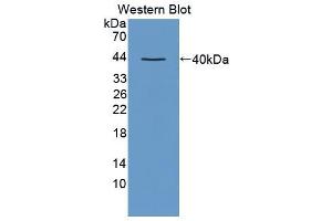 Western blot analysis of the recombinant protein. (CCL3 抗体  (AA 27-92))