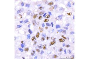 IHC analysis of CRTC3 using anti-CRTC3 antibody (ABIN7599779).