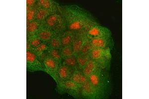IF analysis of RGS9 and Tubulin beta using anti-RGS9 antibody (ABIN7599945) and anti-Tubulin beta antibody (ABIN7602744).