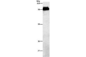 Western Blot analysis of Mouse brain tissue using beta Amyloid Polyclonal Antibody at dilution of 1:1000 (beta Amyloid 抗体)