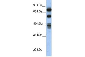 STRBP antibody used at 1 ug/ml to detect target protein. (STRBP 抗体  (Middle Region))