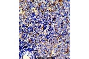 Immunohistochemistry (IHC) image for anti-C-Mer Proto-Oncogene Tyrosine Kinase (MERTK) antibody (ABIN3003537) (MERTK 抗体)