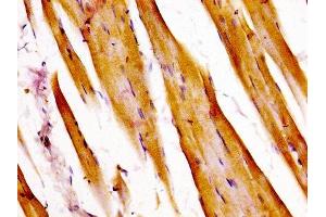 IHC image of ABIN7144797 diluted at 1:400 and staining in paraffin-embedded human skeletal muscle tissue performed on a Leica BondTM system. (ATXN7 抗体  (AA 402-503))