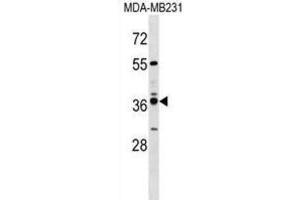 Western Blotting (WB) image for anti-Vomeronasal 1 Receptor 4 (VN1R4) antibody (ABIN3000072)