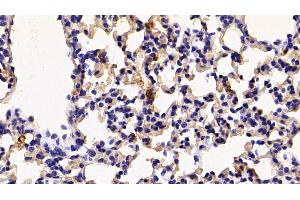Immunohistochemistry (IHC) image for anti-S100 Calcium Binding Protein A8 (S100A8) (AA 1-89) antibody (ABIN7434065)