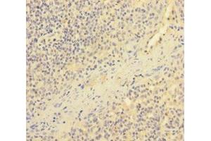 Immunohistochemistry of paraffin-embedded human tonsil tissue using ABIN7151727 at dilution of 1:100 (ESAM 抗体  (AA 30-248))