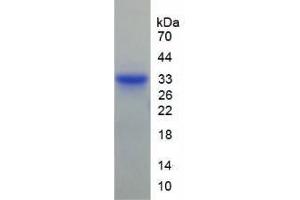 SDS-PAGE analysis of Human Matrix Metalloproteinase 7 (MMP7) Protein. (MMP7 蛋白)
