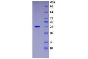 SDS-PAGE (SDS) image for Interleukin 1, beta (IL1B) ELISA Kit (ABIN6574167)