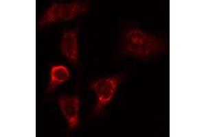 ABIN6275266 staining HeLa cells by IF/ICC. (MYO9B 抗体  (N-Term))