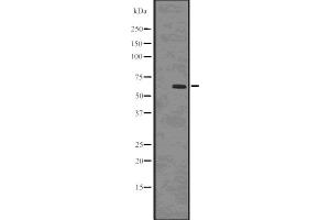 Western blot analysis of Phospho-SQSTM1/p62 (Ser403) using HepG2 whole cell lysates (SQSTM1 抗体  (pSer403))