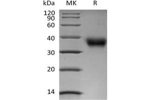 Western Blotting (WB) image for Folate Receptor 1 (Adult) (FOLR1) protein (Biotin,His-Avi Tag) (ABIN7319830) (FOLR1 Protein (Biotin,His-Avi Tag))