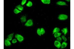 Detection of AST in Hela cells using Polyclonal Antibody to Aspartate Aminotransferase (AST) (GOT1 抗体  (AA 1-413))