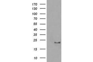 Image no. 1 for anti-HRas proto-oncogene, GTPase (HRAS) antibody (ABIN1498713) (HRAS 抗体)