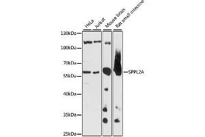 Western blot analysis of extracts of various cell lines, using SPPL2A antibody (ABIN7270297) at 1:1000 dilution. (SPPL2A 抗体  (AA 421-520))