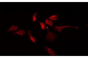 ABIN6267701 staining NIH-3T3 by IF/ICC. (CaMK2 alpha/beta/delta 抗体  (pThr305))