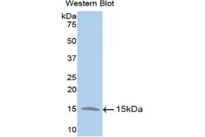 Detection of Recombinant TFF2, Human using Polyclonal Antibody to Trefoil Factor 2 (TFF2) (Trefoil Factor 2 抗体  (AA 27-128))