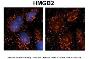 Immunohistochemistry (IHC) image for anti-High Mobility Group Box 2 (HMGB2) (Middle Region) antibody (ABIN2787574)