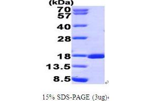 SDS-PAGE (SDS) image for Runt-Related Transcription Factor 3 (RUNX3) (AA 53-186) protein (His tag) (ABIN7279042) (RUNX3 Protein (AA 53-186) (His tag))