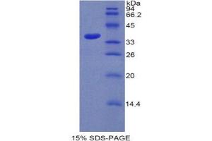 SDS-PAGE (SDS) image for Sulfotransferase Family, Cytosolic, 1A, Phenol-Preferring, Member 1 (SULT1A1) (AA 3-291) protein (His tag) (ABIN2121876)