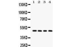 Western Blotting (WB) image for anti-serpin Peptidase Inhibitor, Clade A (Alpha-1 Antiproteinase, Antitrypsin), Member 1 (SERPINA1) (AA 211-411) antibody (ABIN3043431) (SERPINA1 抗体  (AA 211-411))