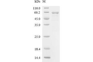 Chaperonin GroEL (GroEL) (AA 1-546), (full length) protein (His tag,MYC tag)