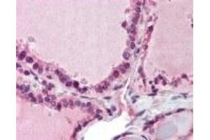 Immunohistochemistry (IHC) image for anti-PAP Associated Domain Containing 7 (PAPD7) (AA 447-462) antibody (ABIN2470063) (PAP Associated Domain Containing 7 (PAPD7) (AA 447-462) 抗体)