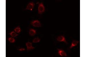 ABIN6275973 staining Hela by IF/ICC. (BAI1 抗体  (Internal Region))