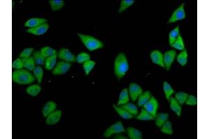 Immunofluorescence staining of Hela cells with ABIN7147569 at 1:133, counter-stained with DAPI. (CLCC1 抗体  (AA 446-551))