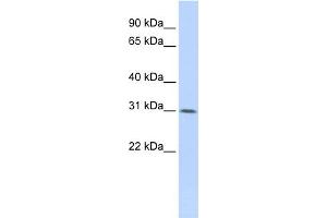 WB Suggested Anti-WDR33  Antibody Titration: 0. (WDR33 抗体  (Middle Region))
