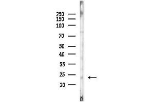 Western blot analysis of lysates from COLO205 cells(heat-shock, 45 min treatment), using PGF Antibody at 1/1000 dilution.