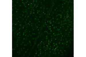 IF analysis of DDX1 using anti-DDX1 antibody (ABIN7602052). (DDX1 抗体  (AA 562-740))