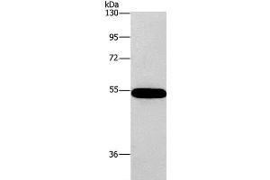 Western Blot analysis of 293T cell using CNDP1 Polyclonal Antibody at dilution of 1:320 (CNDP1 抗体)
