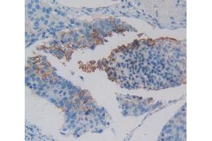 IHC-P analysis of Kidney tissue, with DAB staining. (XCR1 抗体  (AA 43-222))