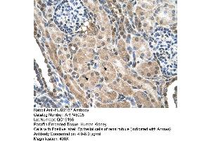 Human kidney (FLJ22167 (N-Term) 抗体)