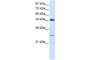 WB Suggested Anti-CLIC4 Antibody Titration:  2. (CLIC4 抗体  (N-Term))