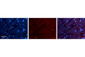 Rabbit Anti-RING1 Antibody Catalog Number: ARP33227_P050 Formalin Fixed Paraffin Embedded Tissue: Human heart Tissue Observed Staining: Nucleus Primary Antibody Concentration: 1:100 Other Working Concentrations: 1:600 Secondary Antibody: Donkey anti-Rabbit-Cy3 Secondary Antibody Concentration: 1:200 Magnification: 20X Exposure Time: 0. (RING1 抗体  (Middle Region))