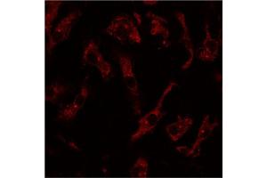 Immunofluorescence - anti-Rab8 Ab at 1/100 dilution using primary macrophages, cells were fixed with 4% of PFA, (RAB8A 抗体  (C-Term))