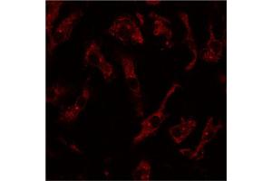 Immunofluorescence - anti-Rab8 Ab at 1/100 dilution using primary macrophages, cells were fixed with 4% of PFA,