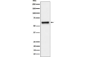 Western blot analysis of FPGS expression in HeLa cell lysate.